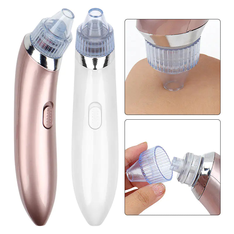 Electric Facial Blackheads Remover